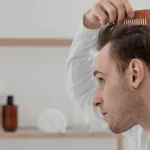 Topical rather than oral treatments for hair loss: finasteride focus